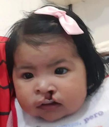 Mia, en brazos de su familia, antes de su cirugía