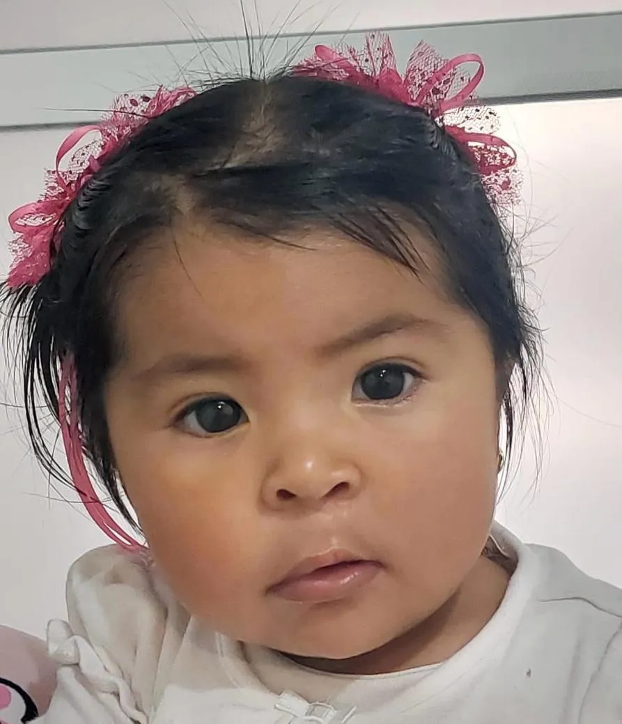 Mia con un moño, ya recuperada de su cirugía