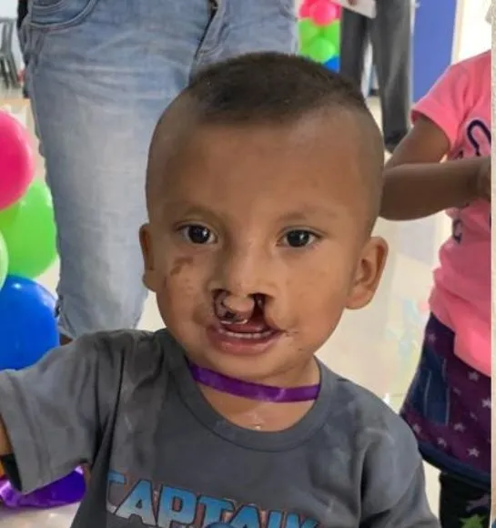 Félix, un niño atendido por la Fundación LPH México