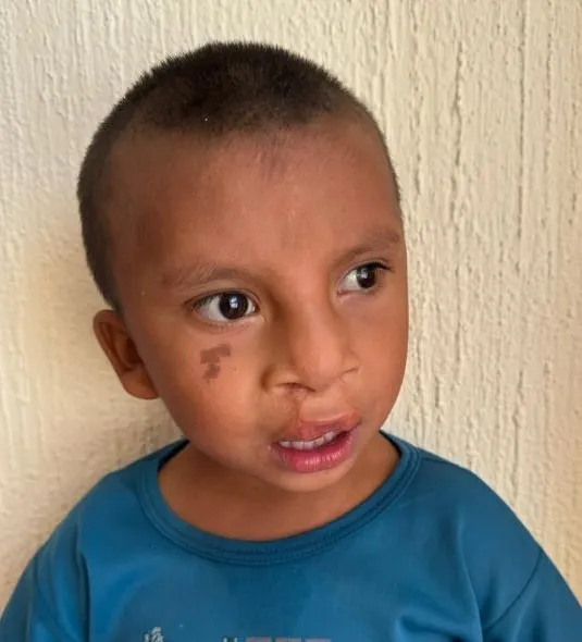 Félix, niño o niña atendido por la Fundación LPH México