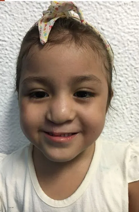 Ozeani, niño o niña atendido por la Fundación LPH México